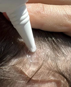 Best Hair Activator - Hårstimulerende serum Hår|Hår