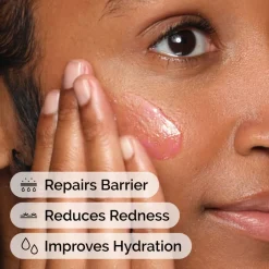 The Ordinary Hudpleje|Hudpleje><noscript><img width=