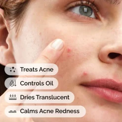 Sulfur 10% Powder-to-Cream Concentrate-The Ordinary Best